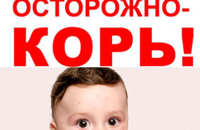 В Новосибирской области стартовала кампания подчищающей иммунизации против кори