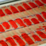 Врач-бактериолог: Основной фактор формирования устойчивости к антибиотикам — нарушение режима приема лекарств